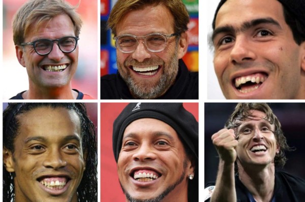 Cristiano Ronaldo el más llamativo: Deportistas famosos a los que el dentista les cambió la vida&nbsp;&nbsp;