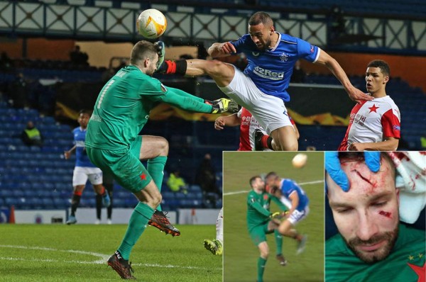 ¡Brutal patada en la Europa League! Delantero del Rangers le partió el rostro al portero del Slavia Praga