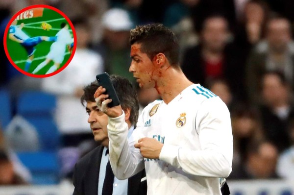 ¡PATADÓN! Así le dejaron el rostro a Cristiano Ronaldo
