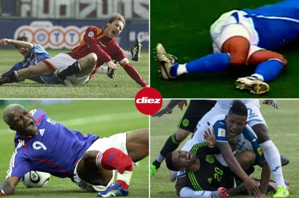 ¡No apto para sensibles! Las lesiones más escalofriantes que se han visto en el fútbol