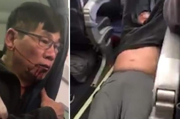 El oscuro pasado del doctor David Dao, pasajero expulsado de un avión de United