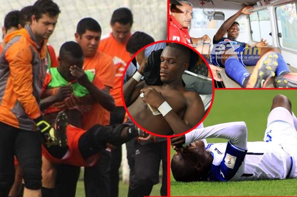 Rubilio Castillo, un goleador marcado por las aparatosas lesiones