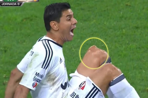 ¡No apto para sensibles! Las lesiones más escalofriantes que se han visto en el fútbol