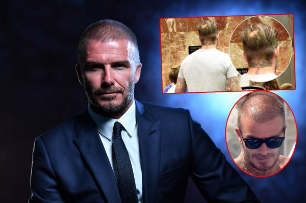 En fotos: ¿David Beckham se está quedando calvo?