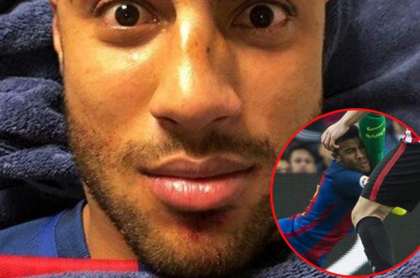 ¡La escalofriante imagen de Rafinha con la ceja cortada!