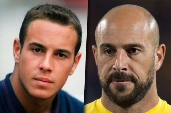 TOP 15: Los futbolistas que han quedado calvos a lo largo de su carrera