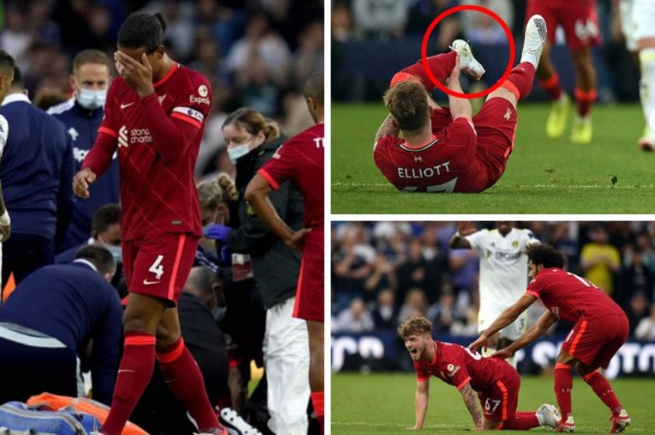 No apto para sensibles: Así fue la escalofriante lesión de Harvey Elliott del Liverpool; sufrimiento y shock de Klopp&nbsp;&nbsp;