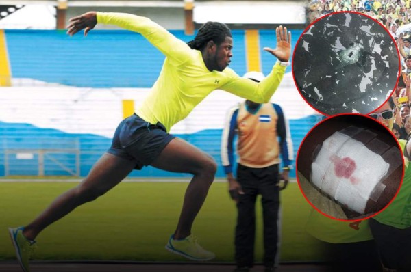 Atleta hondureño es herido de bala en intento de asalto en San Pedro Sula