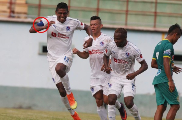 Carlo Costly, el nuevo capitán del Olimpia para el Apertura-2017