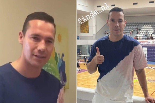 ¡Hizo un Héctor Herrera! Figura de los Tigres se opera la cara y así luce ahora; está irreconocible