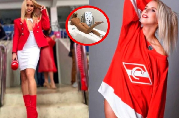 El parte médico más sexy que presentó el Spartak de Moscú