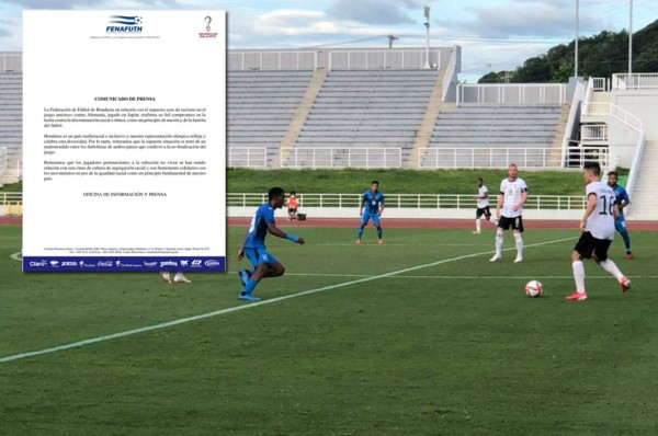 Federación de Honduras responde a las acusaciones de supuesto racismo: 'Se trató de un malentendido'