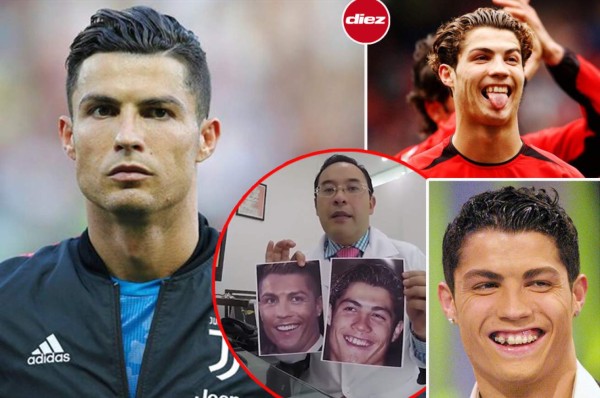 Cristiano Ronaldo: Desvelan las cinco cirugías que se realizó para cambiar su imagen