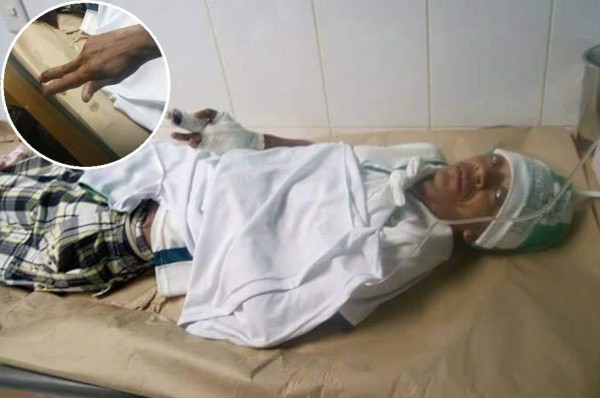 Así fue como perdió el dedo aficionado de Platense al festejar gol