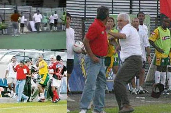 ¡Impresionante! El día que Jorge Luis Pinto recibió terrible golpe en la cara