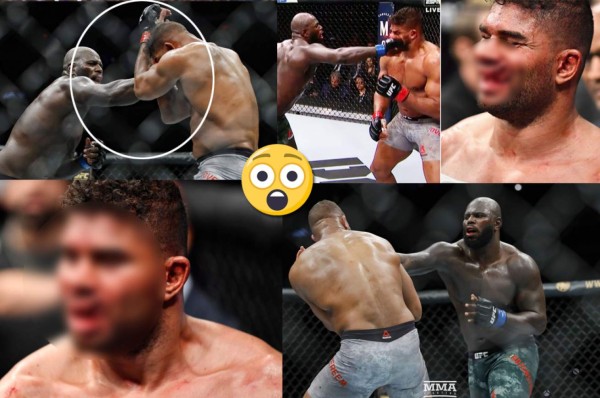 ¡Terribles fotos! De un brutal golpe le rompen los labios a un peleador en la UFC