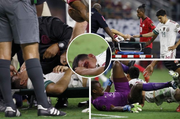 Escalofriante: así quedó el rostro de Chucky Lozano tras el duro choque con el portero de Trinidad y Tobago en la Copa Oro
