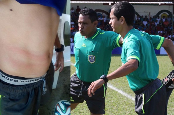 Árbitro denuncia que fue agredido por sancionarle penal al Olimpia