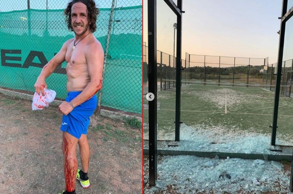 Puyol queda ensangrentado luego de impactar contra una puerta de cristal