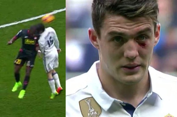 Kovacic choca con un rival y sufre terrible herida bajo el ojo izquierdo