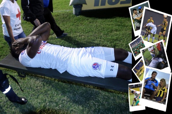 Las imágenes que la televisión no mostró de la jornada 17 en Honduras