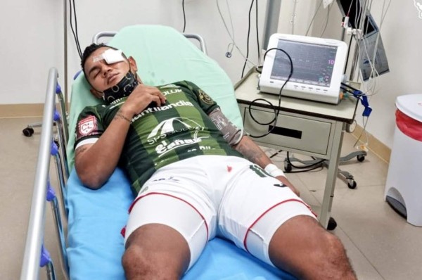 Las fuertes imágenes que filtra el Marathón de cómo quedó Mario Martínez tras golpe de Jonathan Paz