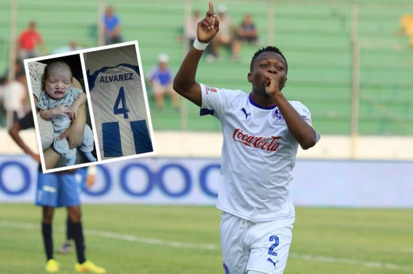 Kevin Álvarez se solidariza con niño que padece de labio leporino