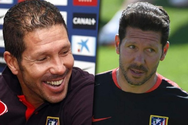 Famosos futbolistas que no soportaron su calvicie y decidieron hacerse injerto capilar