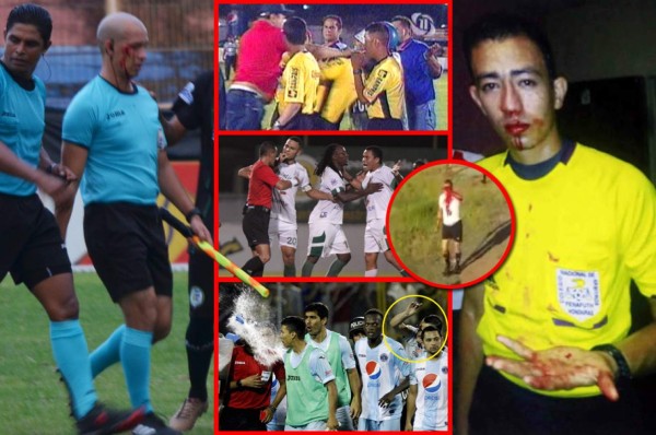¡Ya paren! Las repudiables agresiones a los árbitros en el fútbol hondureño