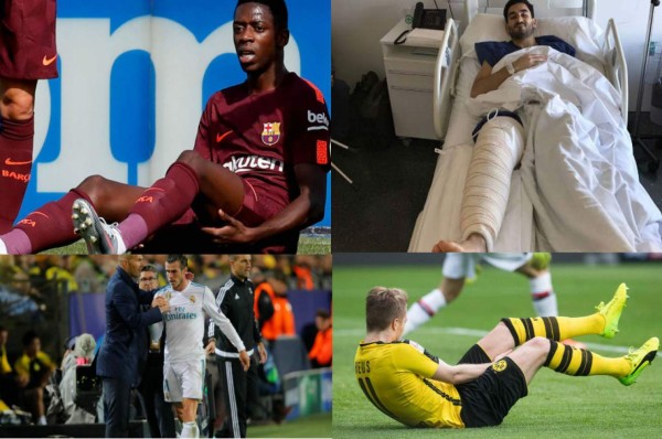 Ousmane Dembelé y el gran club de los 'futbolistas de cristal'