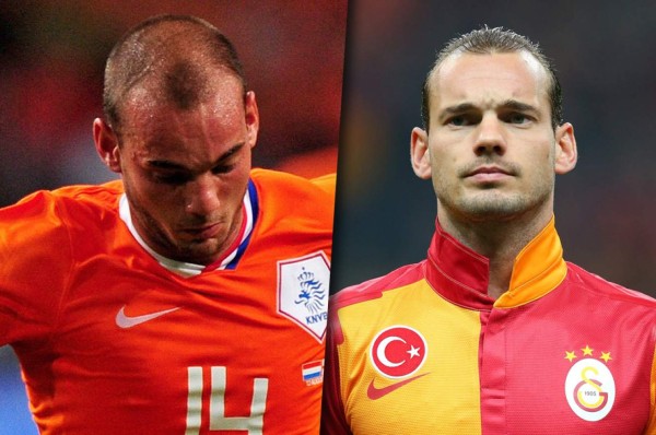 Famosos futbolistas que no soportaron su calvicie y decidieron hacerse injerto capilar