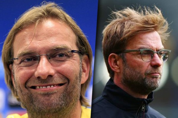 Famosos futbolistas que no soportaron su calvicie y decidieron hacerse injerto capilar