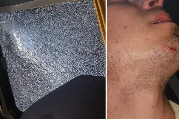 FOTOS: El cobarde ataque al Alianza de El Salvador en Tegucigalpa