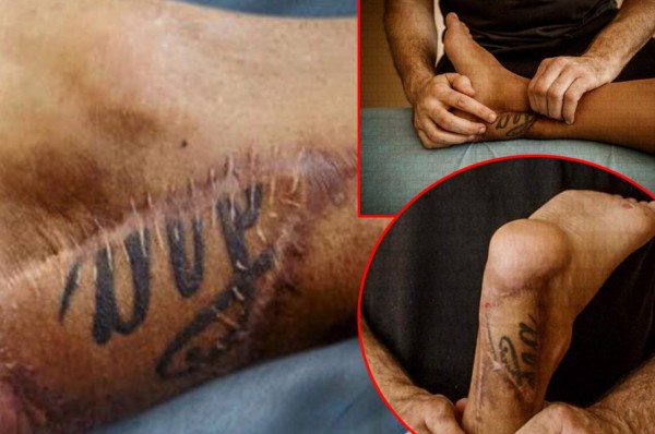 Impactante: La lesión que tiene retirado del fútbol a bicampeón de Euro con España