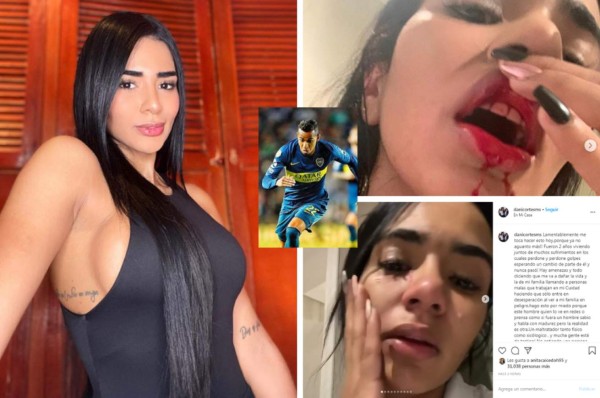 Sebastián Villa, futbolista de Boca Juniors, propinó brutal paliza a su esposa y esta lo denunció