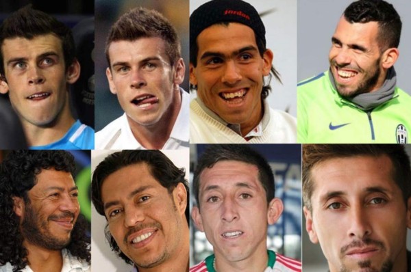 Futbolistas que se han hecho cirugía estética para verse mejor