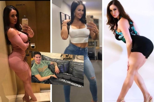 Famosa actriz de cine para adultos, preocupada por la lesión de testículos de James Rodríguez