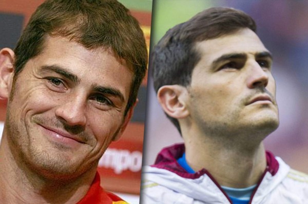 Famosos futbolistas que no soportaron su calvicie y decidieron hacerse injerto capilar