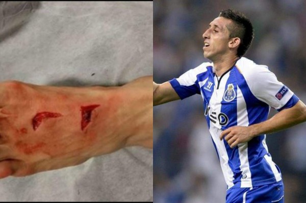 ¡ESCALOFRIANTE! La brutal entrada que recibió Héctor Herrera contra la Juventus