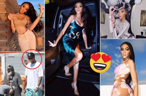 Winnie Harlow, preciosa modelo que padece de vitiligo, es 'cazada' con famoso deportista