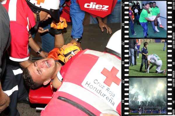 Las imágenes que la televisión no mostró de la ida de la final en Honduras