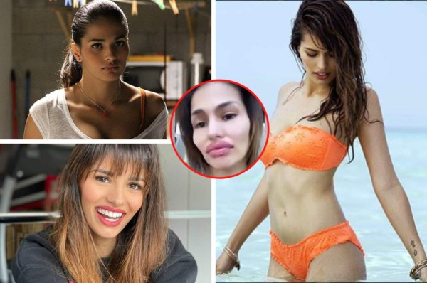 '¿Qué te ha pasado?' Mujer de crack del Real Madrid es atacada por su impactante aumento de labios&nbsp;&nbsp;