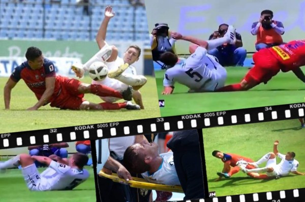 La espeluznante lesión de un jugador de Comunicaciones ante Municipal en Guatemala