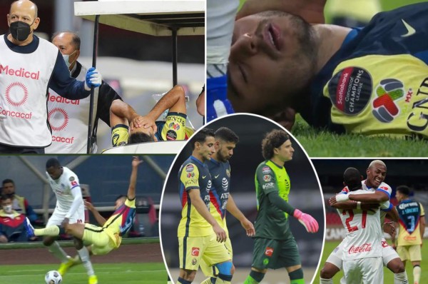 En fotos: 'Memo' Ochoa explotó contra Arboleda; Nicolás Benedetti dio el gran susto