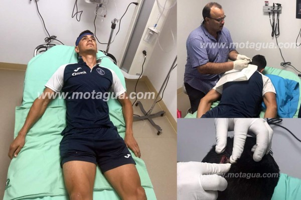 Roberto Moreira pasó por el quirófano tras el Marathón-Motagua