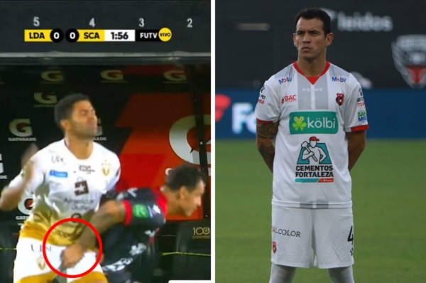 Daniel Arreola, compañero de Alex López en Alajuelense, castigado por sujetarle los genitales a un rival
