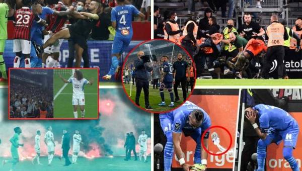 Los incidentes ocurridos el domingo en el partido entre el Lyon y el Marsella, donde lanzaron un botellazo al rostro de Dimitri Payetse añaden a una lista repleta de altercados esta temporada en la Ligue 1 de Francia. Estos son todos los incidentes ocurridos en la campaña.