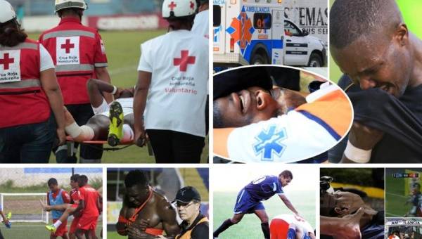 John Paul Suazo ha sufrido una fractura en la tibia y es el último que se une a la lista de graves lesiones en el fútbol de Honduras.