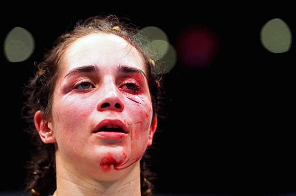 FOTOS: El antes y después de Verónica Macedo tras paliza en la UFC