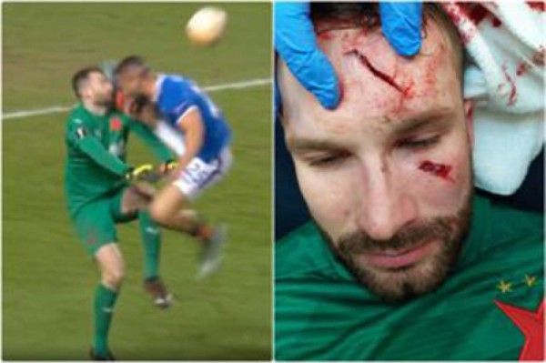 ¡Brutal patada en la Europa League! Delantero del Rangers le partió el rostro al portero del Slavia Praga